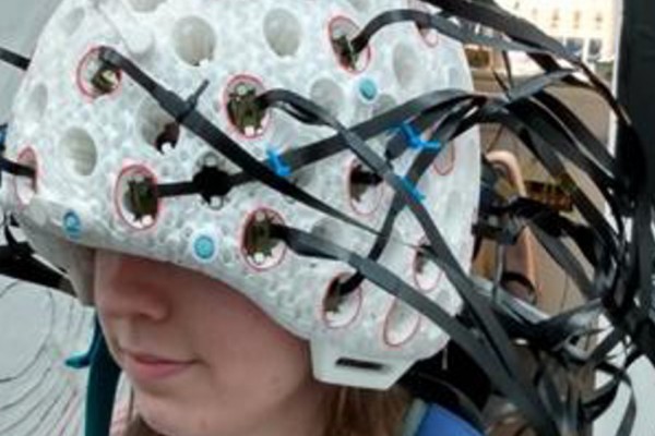 توسعه‌ي اسکنر پوشیدنی مغز برای تصویربرداری از کل سر 